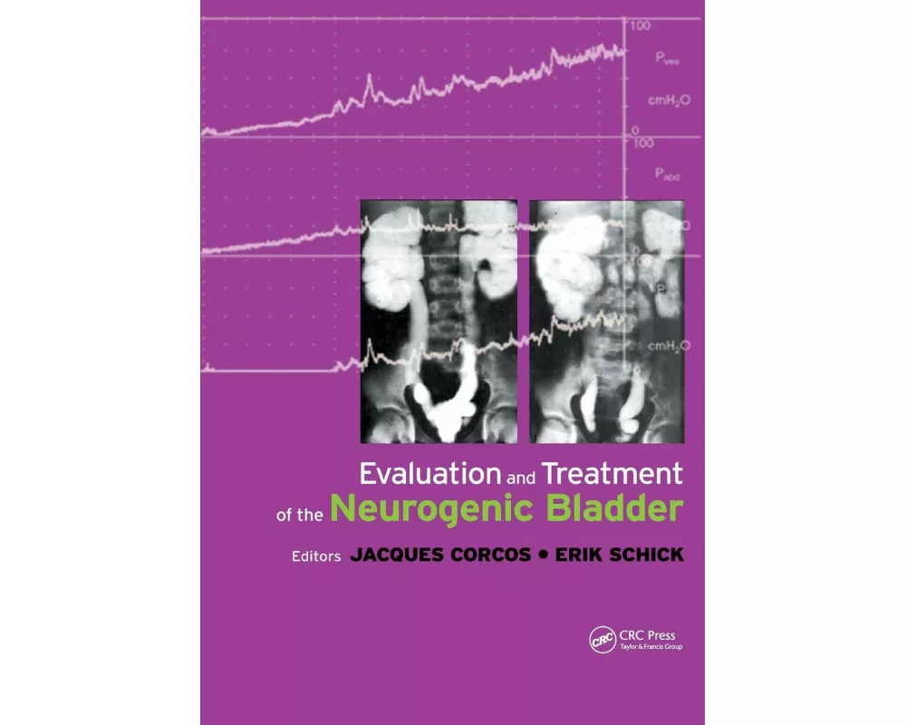 Evaluation and Treatment of the Neurogenic Bladder