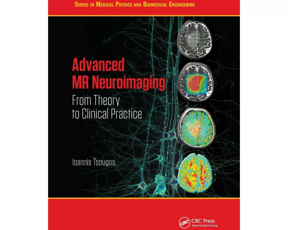 Advanced MR Neuroimaging