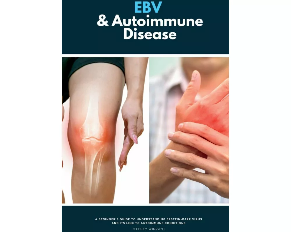 EBV & Autoimmune Disease