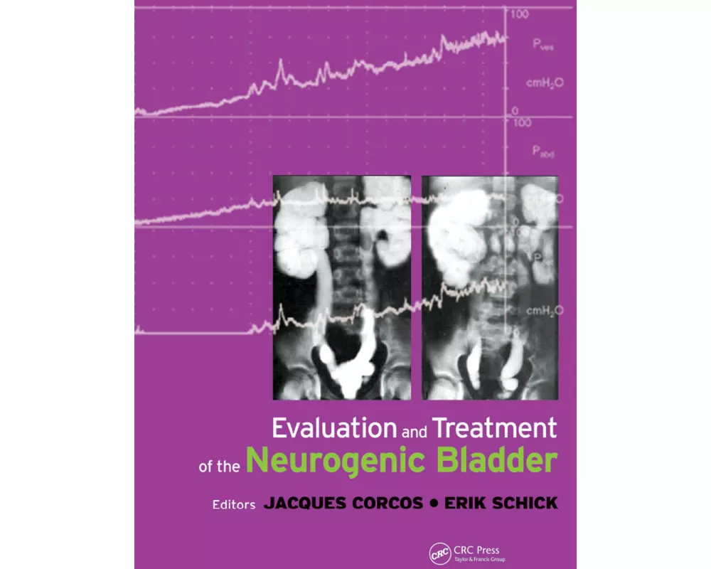 Evaluation and Treatment of the Neurogenic Bladder