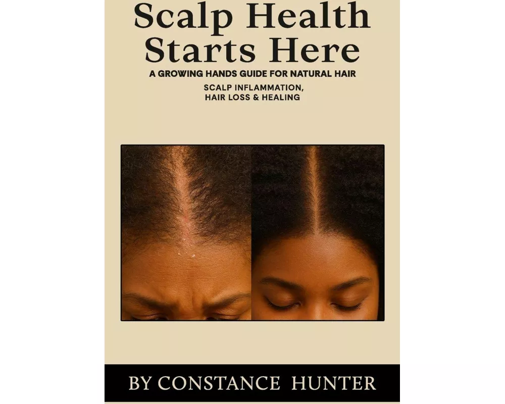 Scalp Health Starts Here