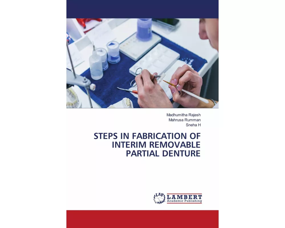 Steps In Fabrication Of Interim Removable Partial Denture