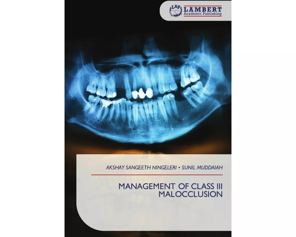 Management Of Class Iii Malocclusion