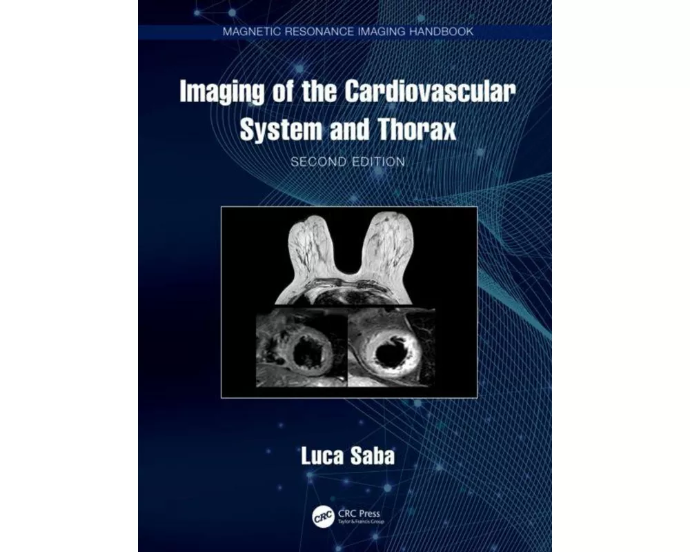 Imaging of the Cardiovascular System and Thorax