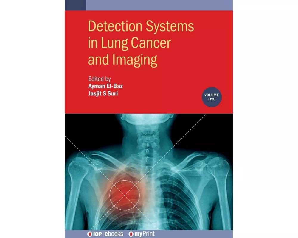 Detection Systems in Lung Cancer and Imaging, Volume 2