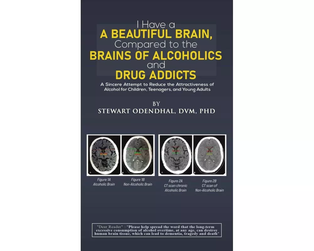 I Have a Beautiful Brain, Compared to the Brains of Alcoholics and Drug Addicts