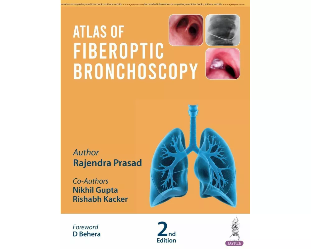 Atlas of Fiberoptic Bronchoscopy