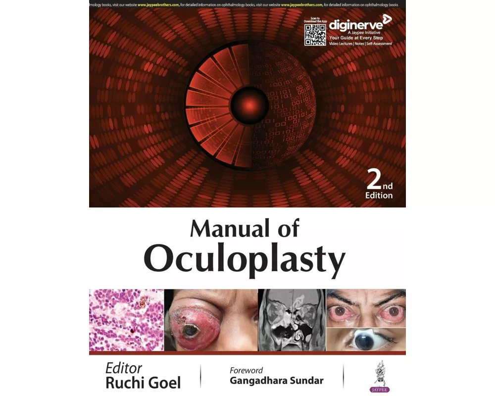 Manual of Oculoplasty