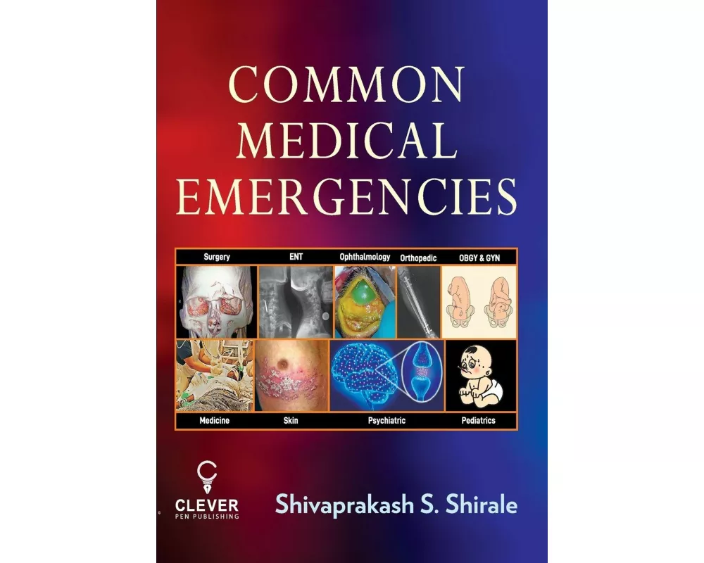 Common Medical Emergencies
