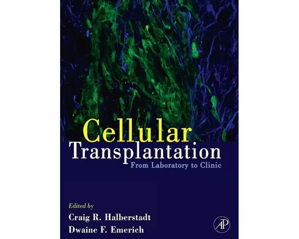 Cellular Transplantation