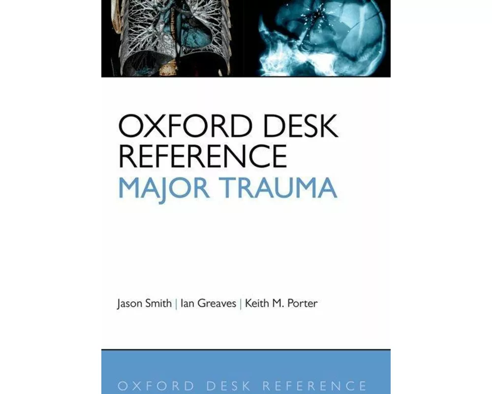 Oxford Desk Reference: Major Trauma