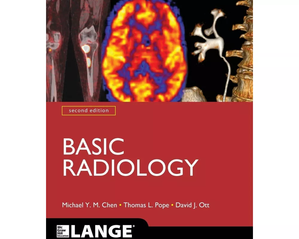 Basic Radiology, Second Edition