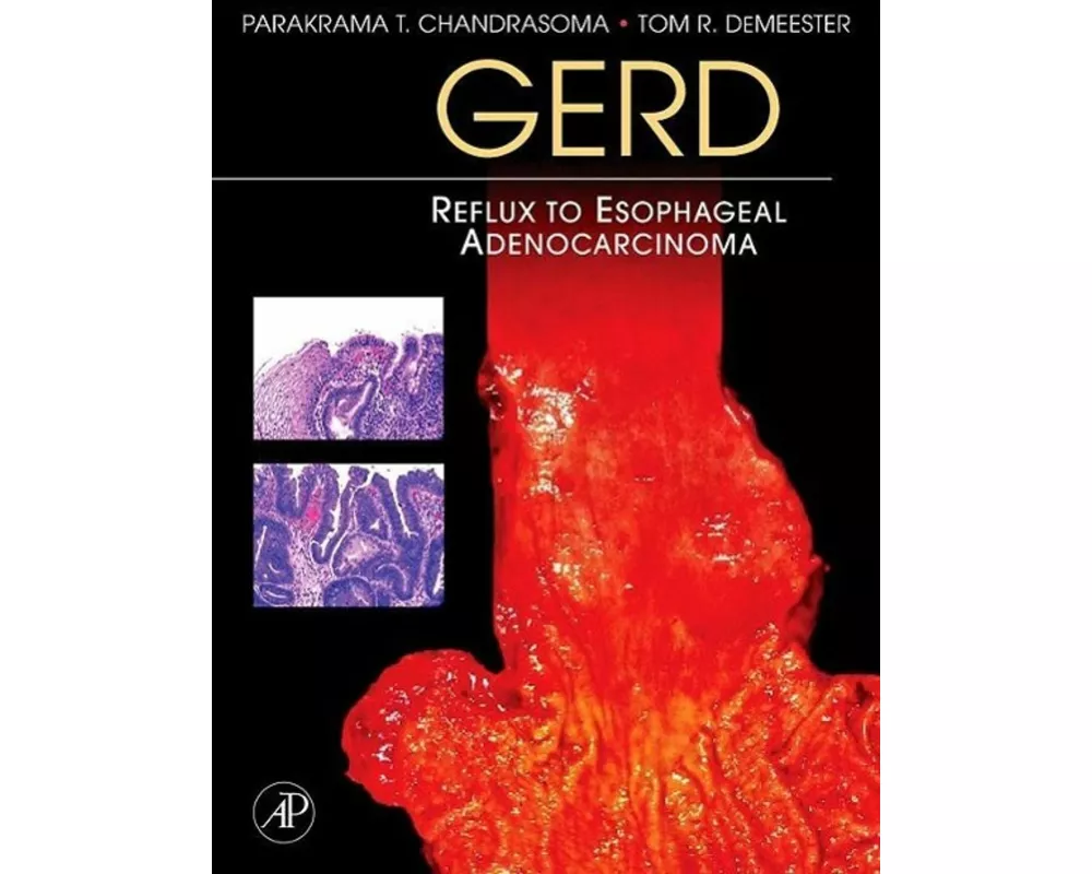 Gerd