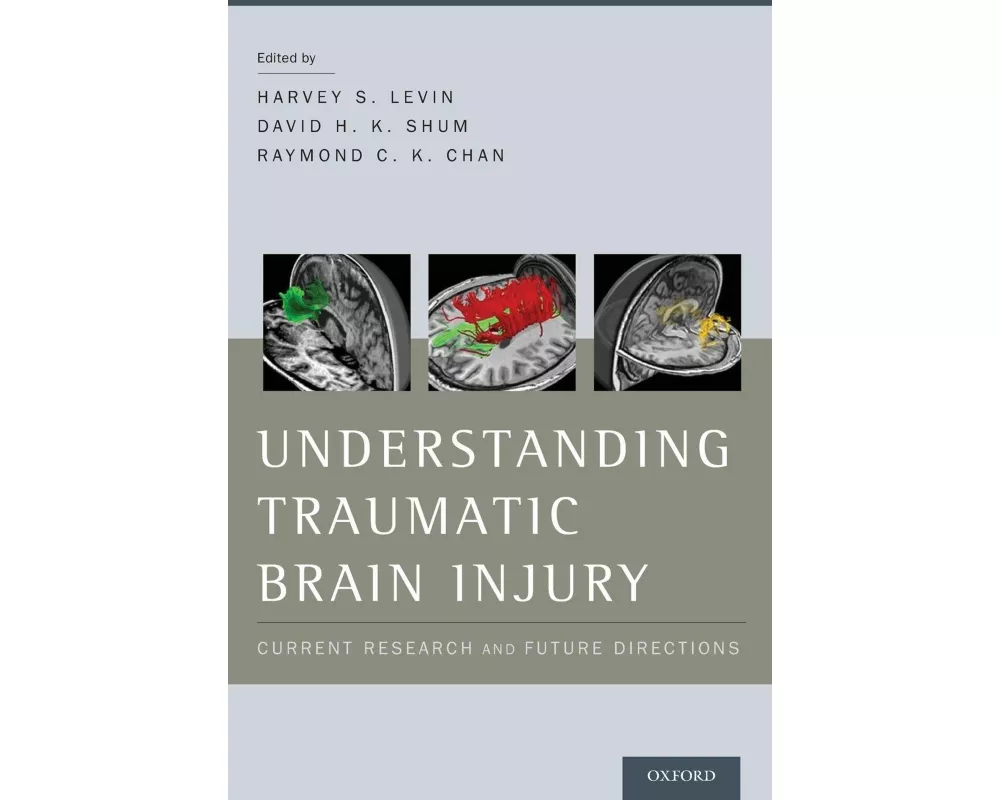 Understanding Traumatic Brain Injury