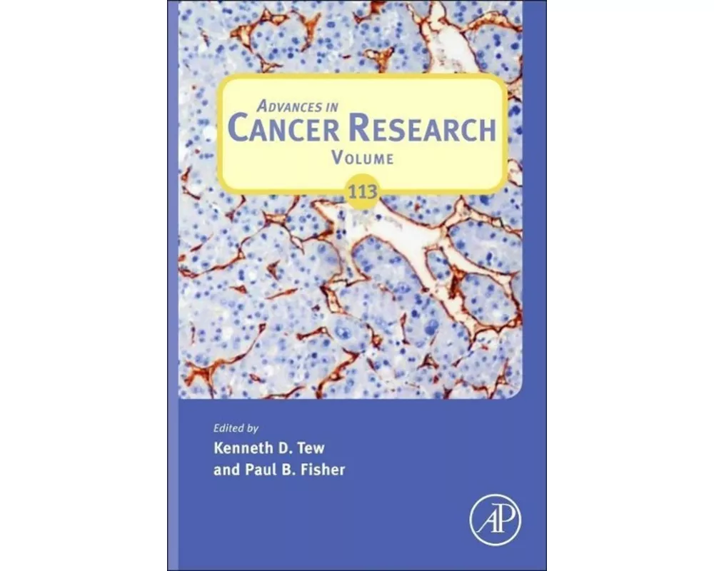 Advances in Cancer Research: Volume 113