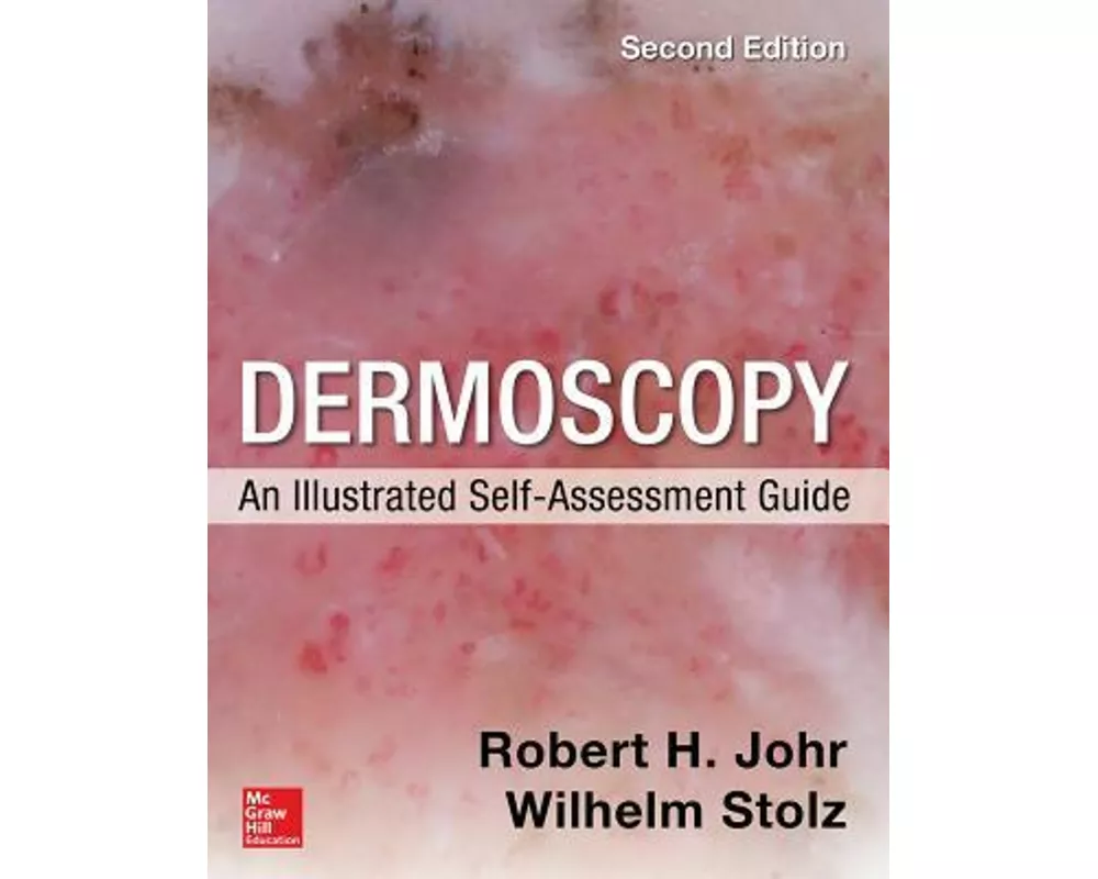 Dermoscopy: An Illustrated Self-Assessment Guide, 2/e