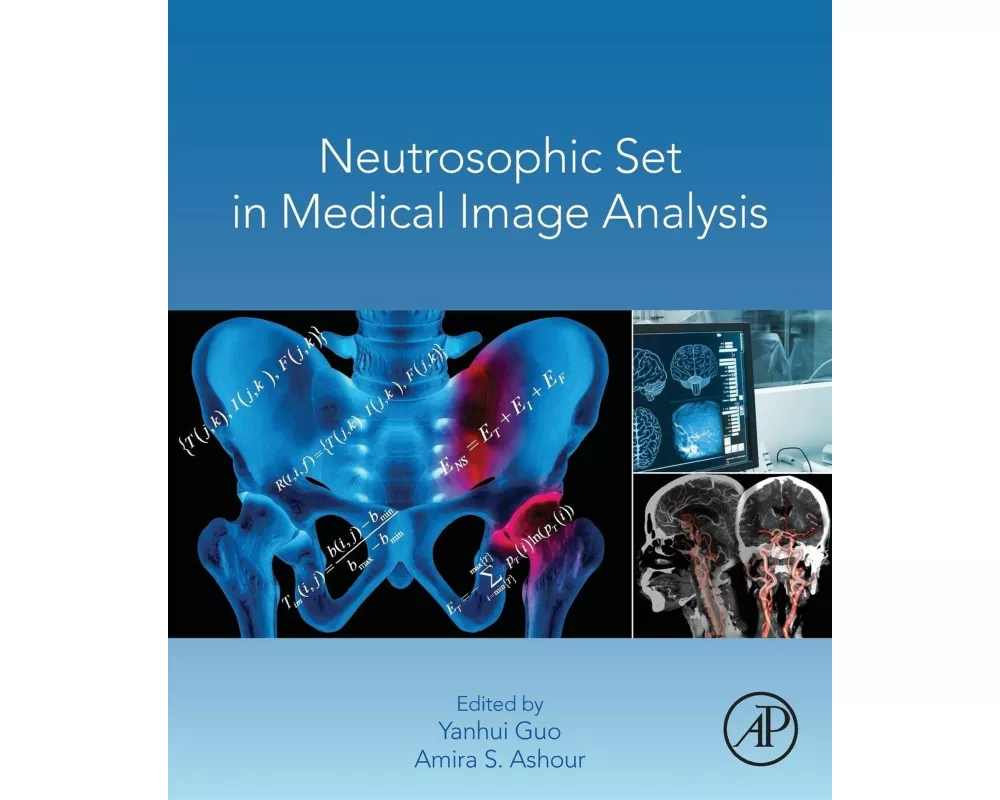 Neutrosophic Set in Medical Image Analysis