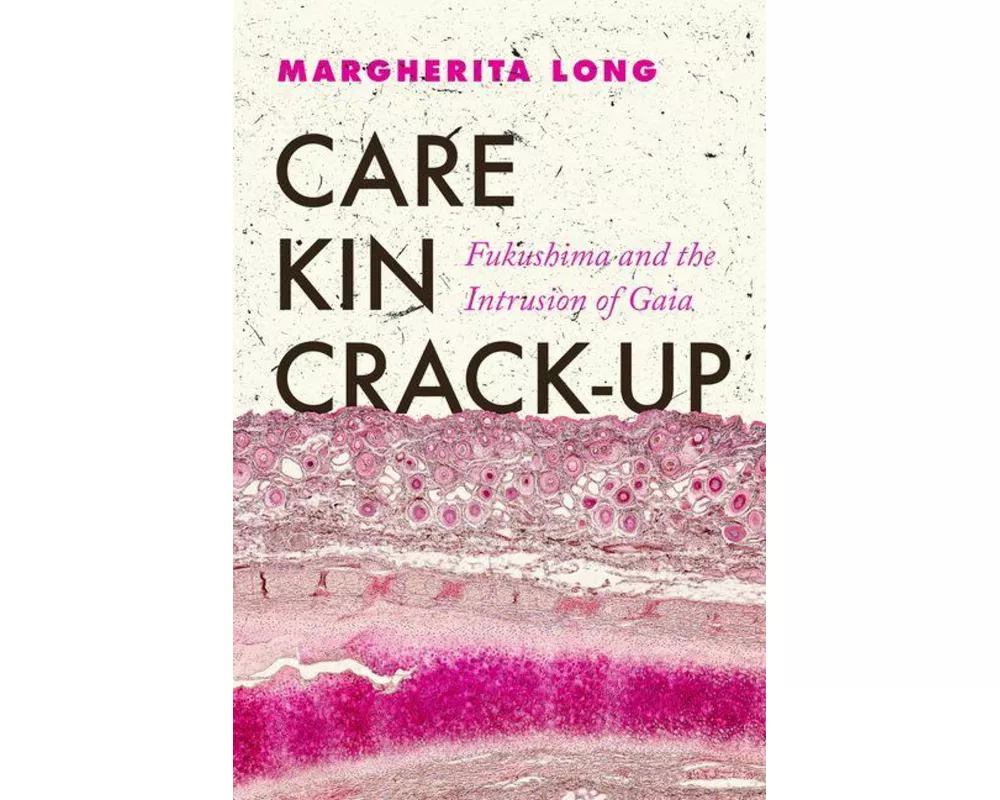 Care, Kin, Crack-Up