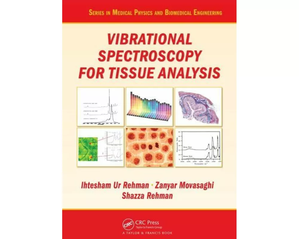 Vibrational Spectroscopy for Tissue Analysis