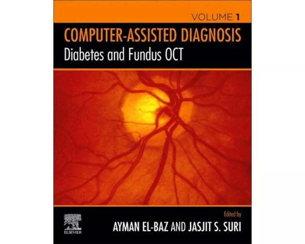 Diabetes and Fundus Oct