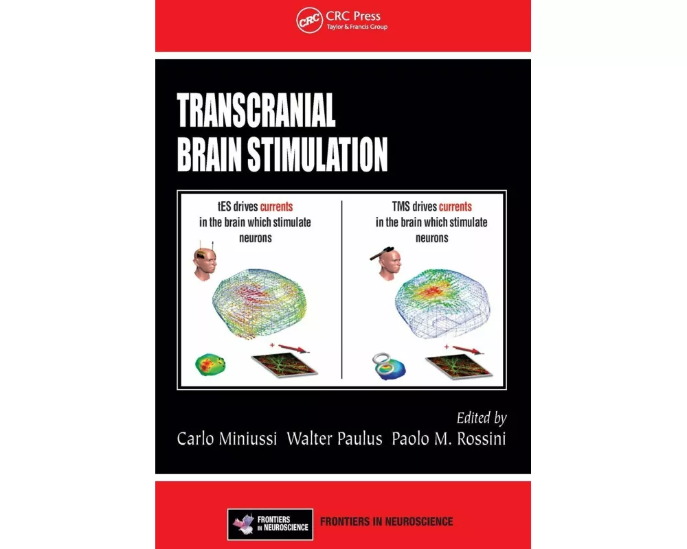 Transcranial Brain Stimulation