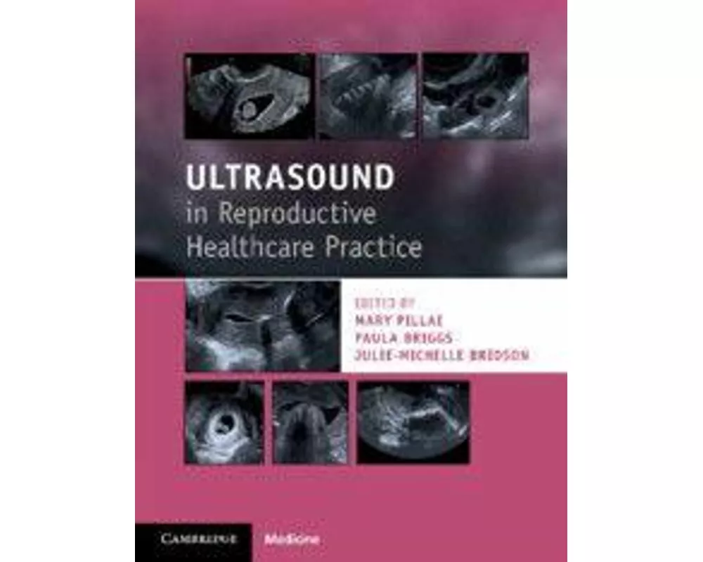 Ultrasound in Reproductive Healthcare Practice