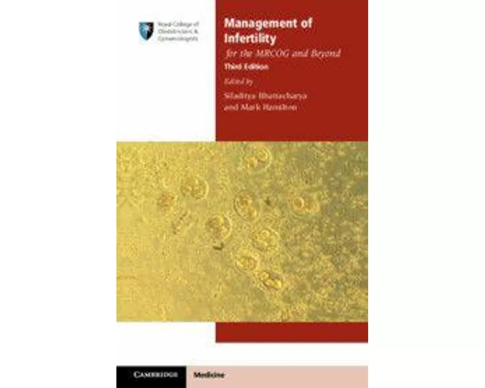 Management of Infertility for the MRCOG and Beyond
