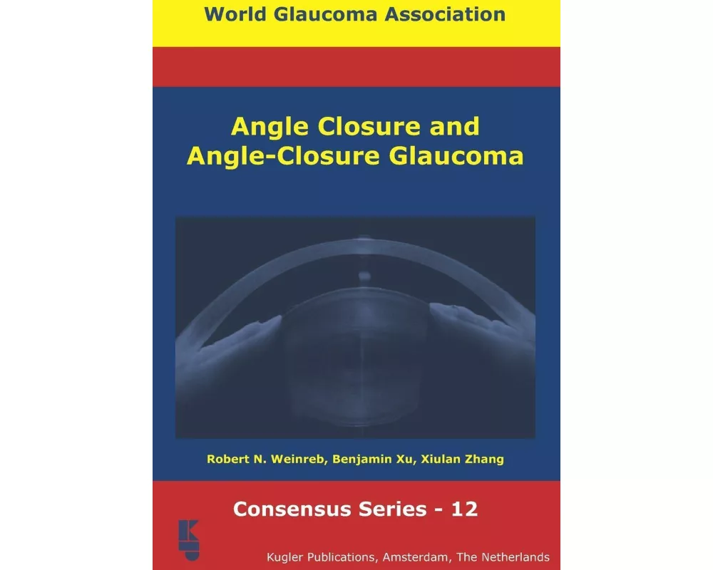 Angle Closure and Angle-Closure Glaucoma