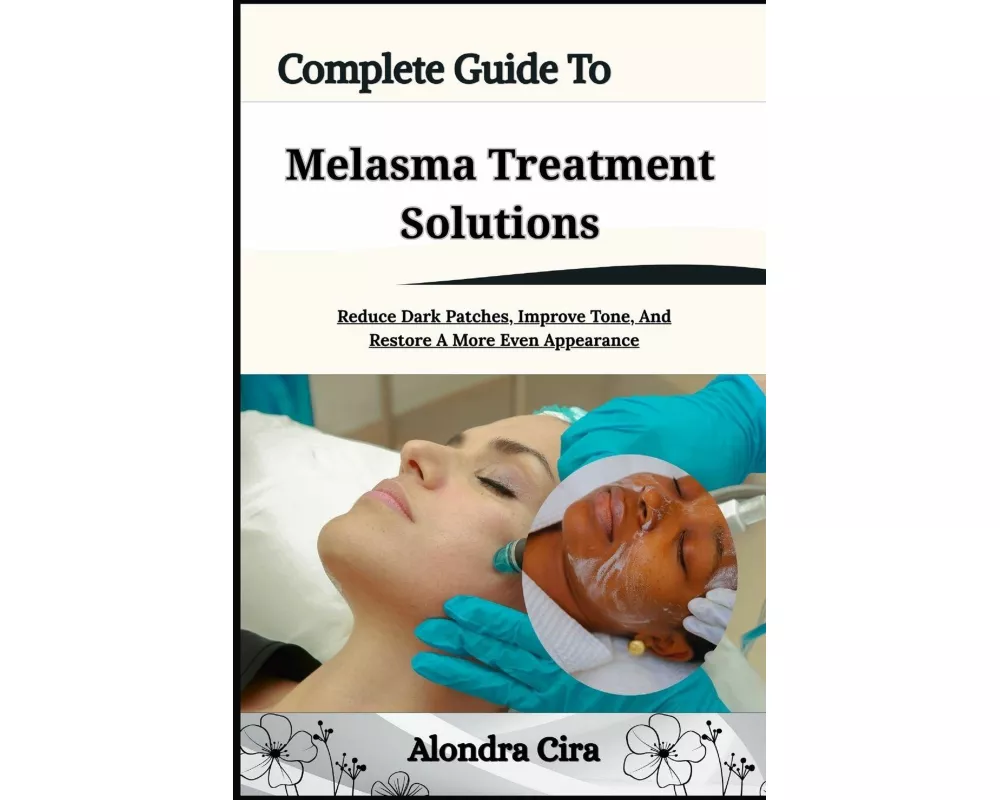 Complete Guide To Melasma Treatment Solutions