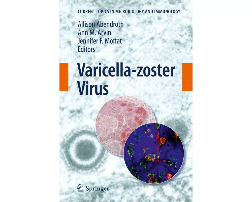 Varicella-zoster Virus