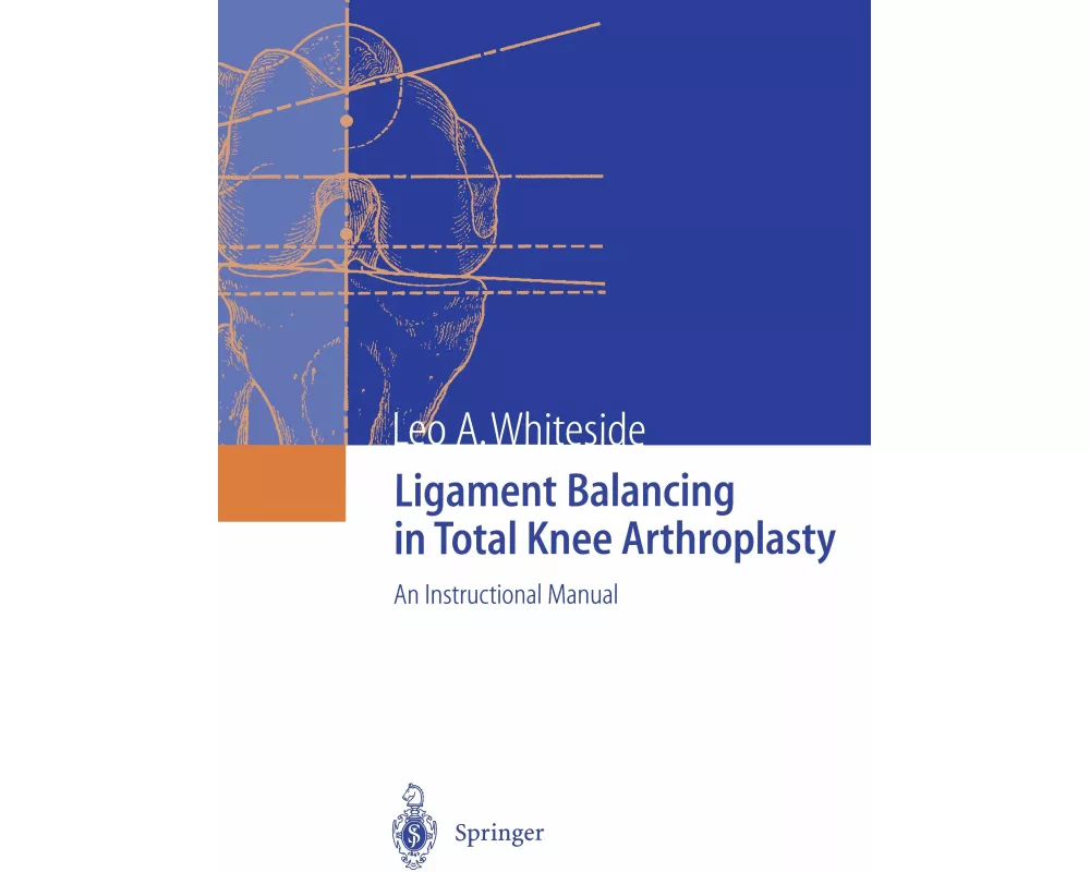 Ligament Balancing in Total Knee Arthroplasty