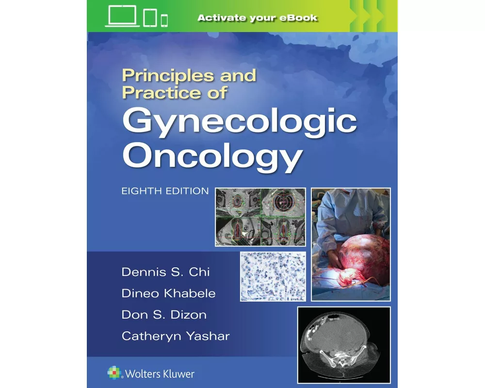 Principles and Practice of Gynecologic Oncology