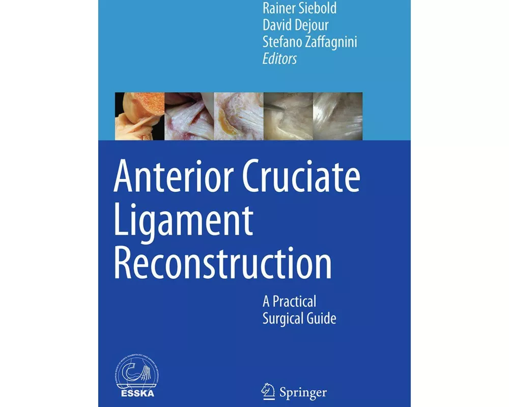 Anterior Cruciate Ligament Reconstruction