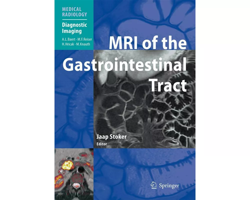 MRI of the Gastrointestinal Tract