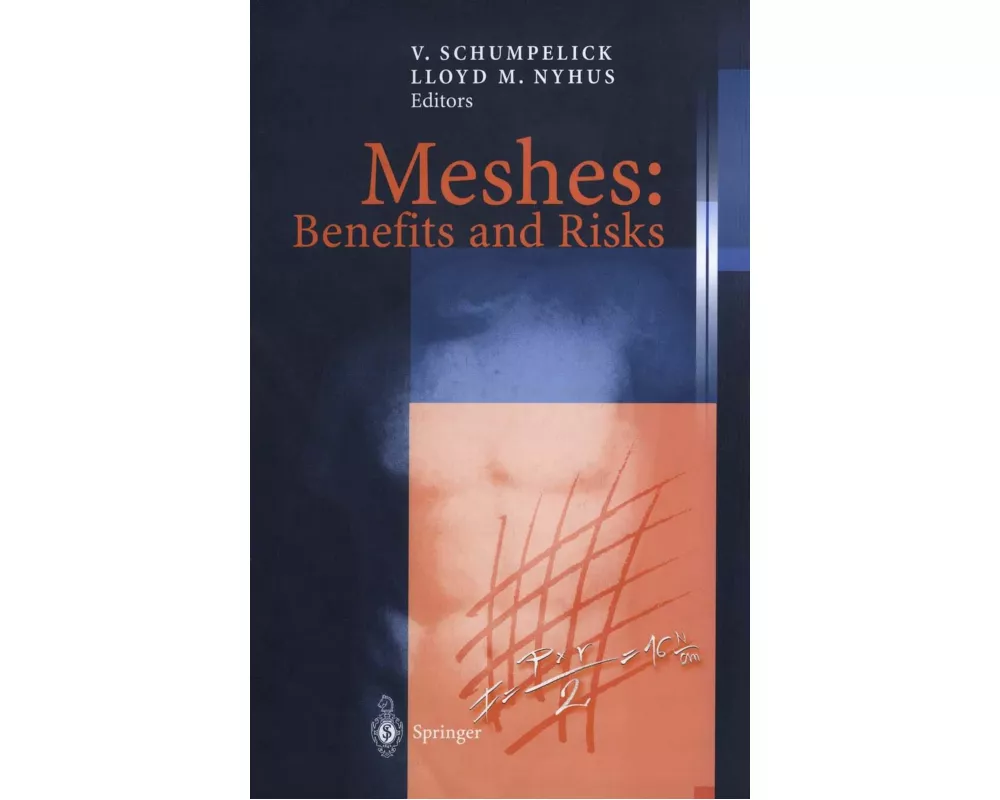 Meshes: Benefits and Risks