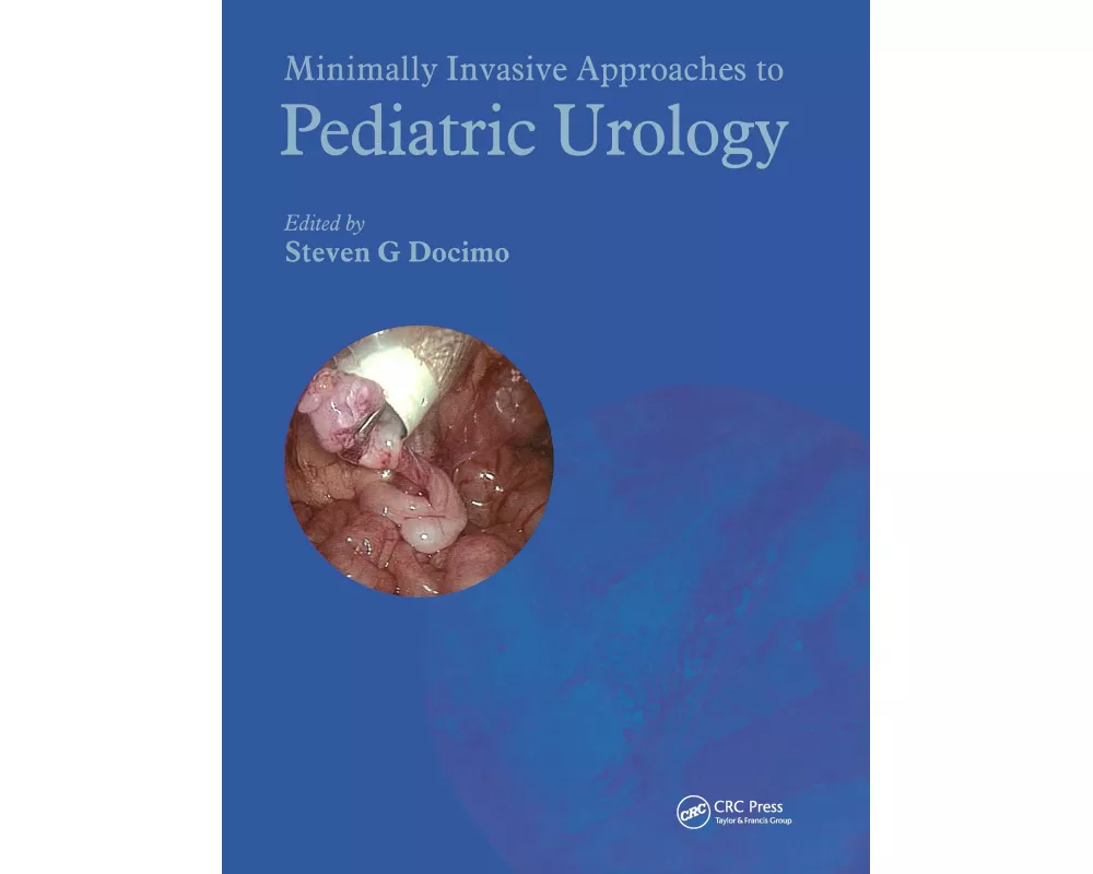 Minimally Invasive Approaches to Pediatric Urology