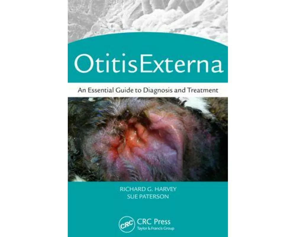Otitis Externa