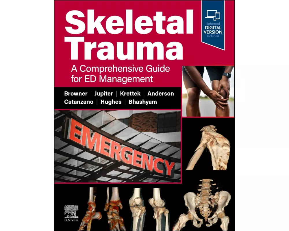 Skeletal Trauma