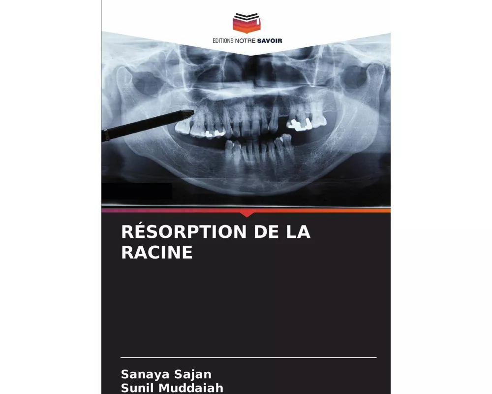 RÉsorption De La Racine