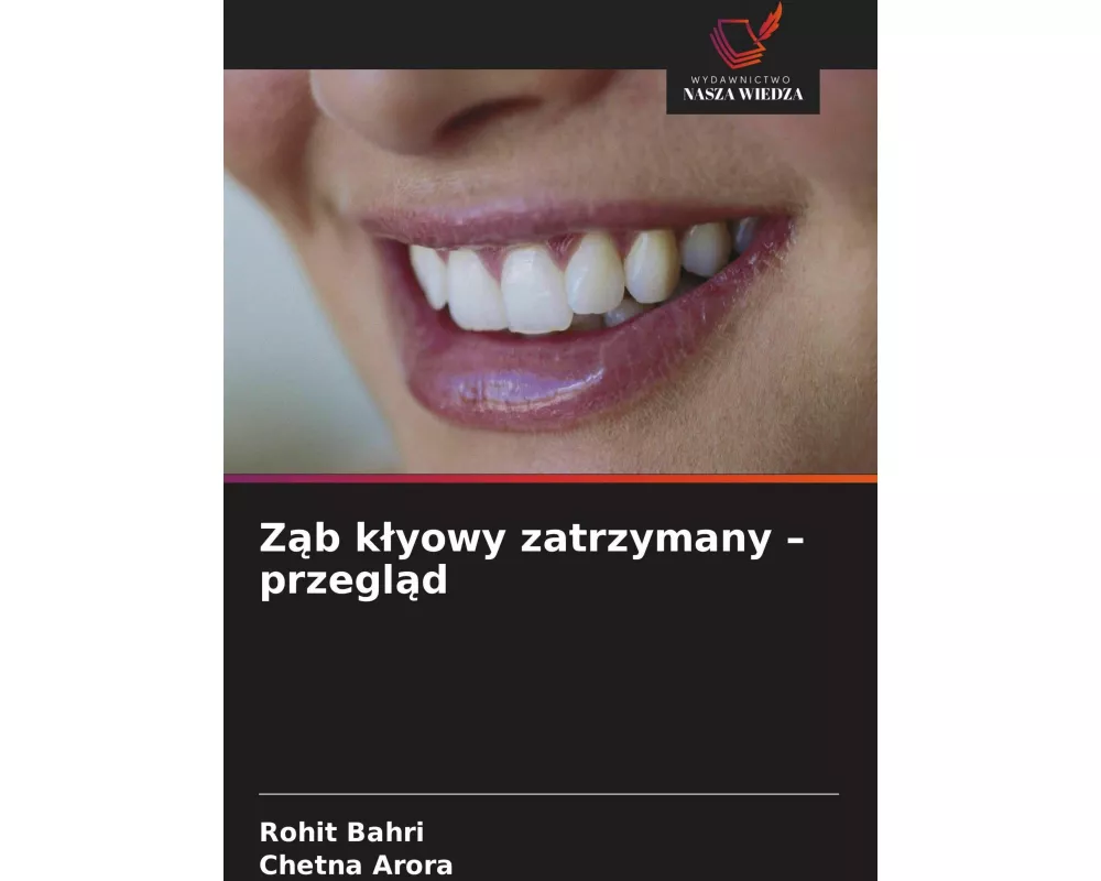 Z¿b k¿yowy zatrzymany - przegl¿d
