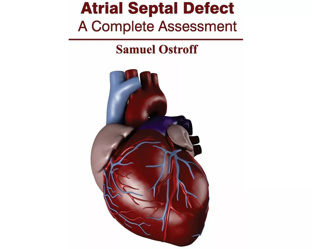 Atrial Septal Defect