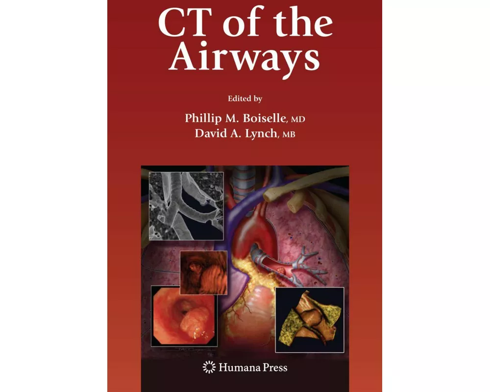 CT of the Airways