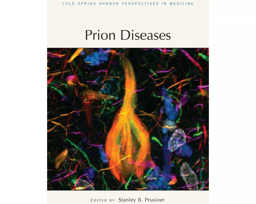 Prion Diseases