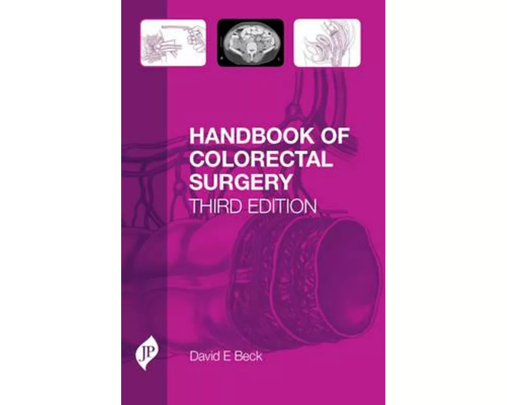 Handbook of Colorectal Surgery