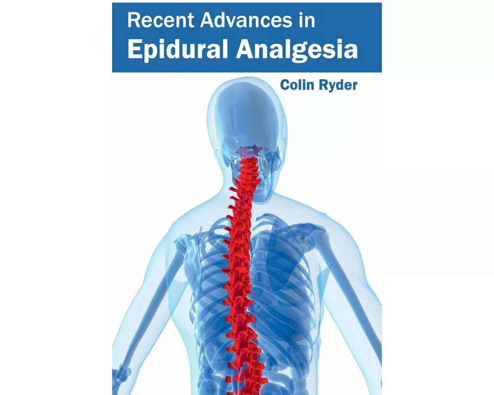Recent Advances in Epidural Analgesia