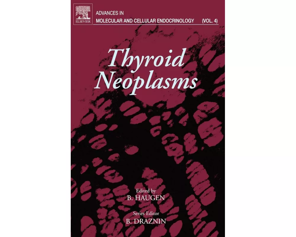 Thyroid Neoplasms