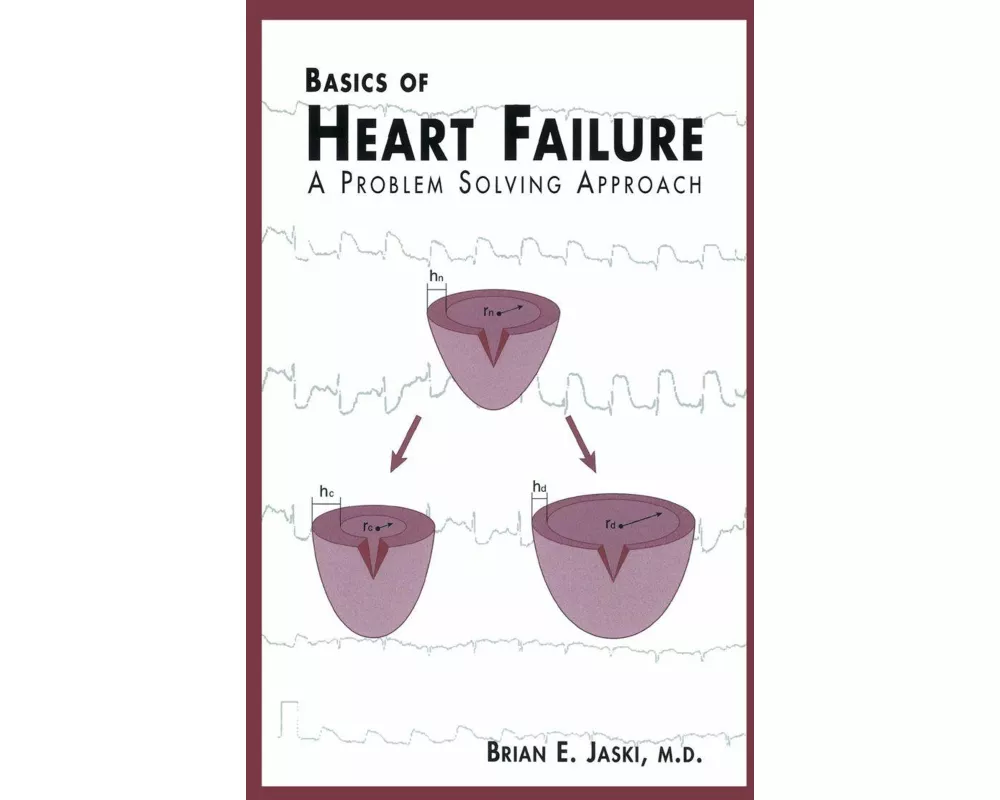 Basics of Heart Failure