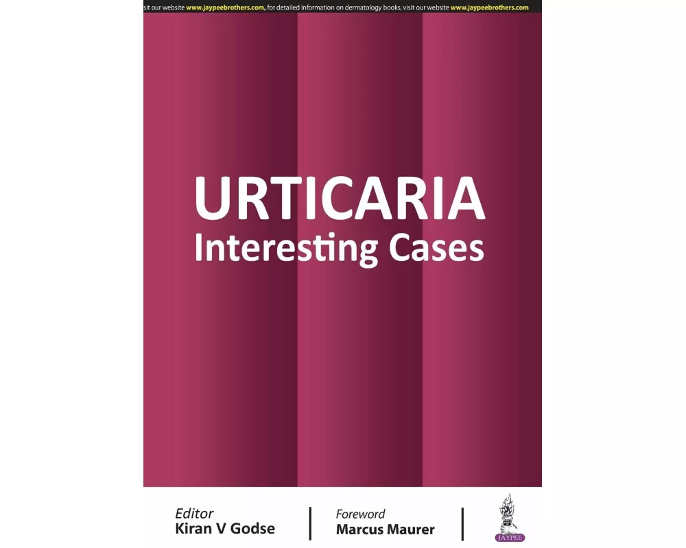 Urticaria