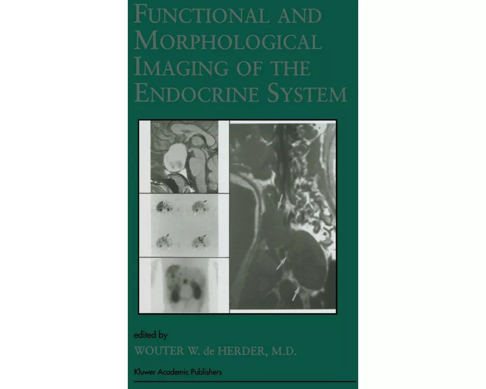 Functional and Morphological Imaging of the Endocrine System