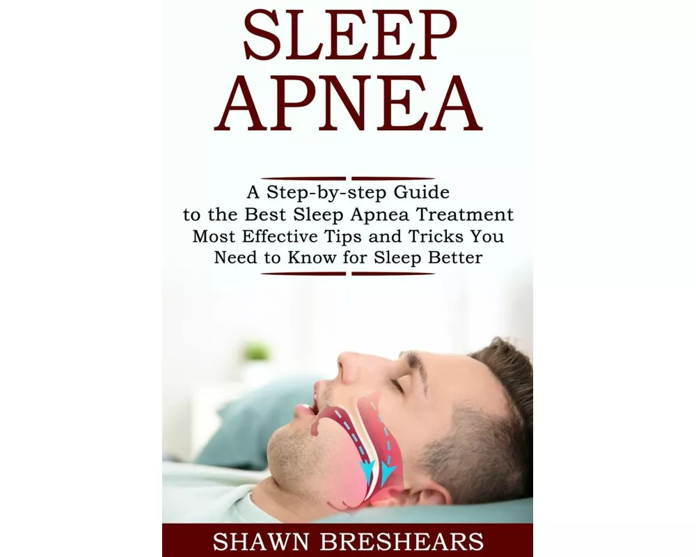 Sleep Apnea